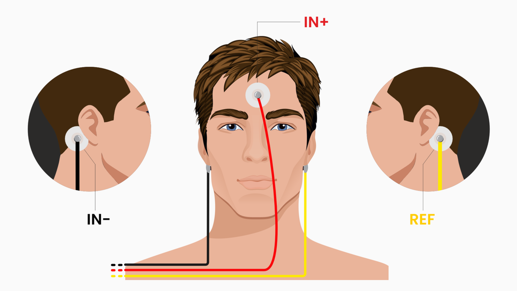 electrode_placement